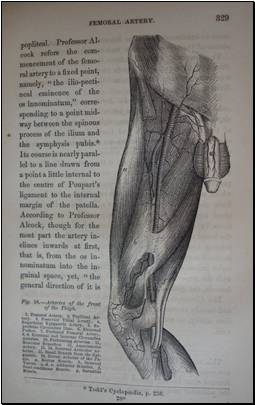 anatomy of the arteries John Hatch Power